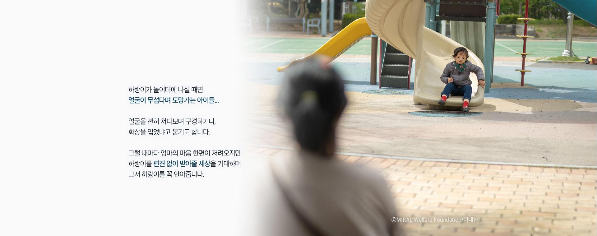 ＂엄마! 쟤 얼굴 이상해＂